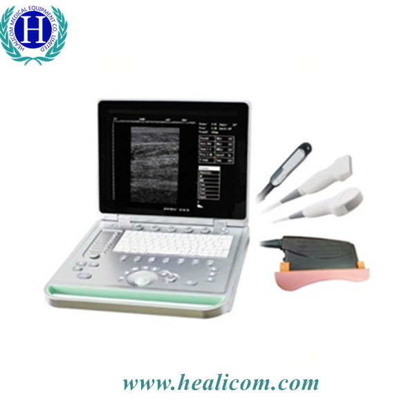 HV-7 Fill Digital B Mode แล็ปท็อปแบบพกพา Medical Veterinary Ultrasound Scanner Diagnostic Vet Ultrasound Machine