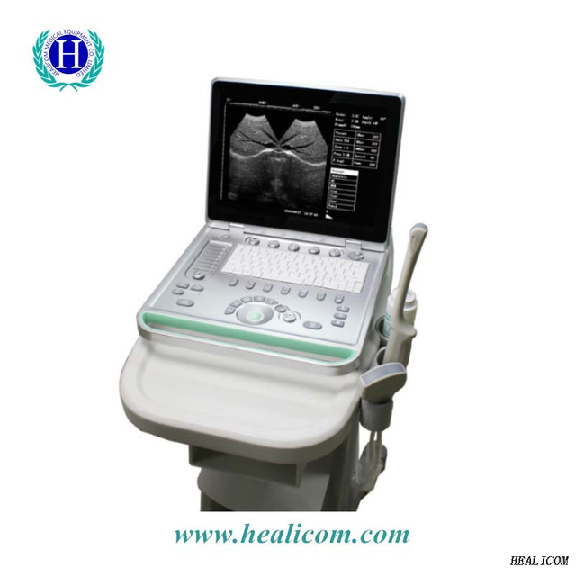 HV-7 Full Digital B Mode แล็ปท็อปแบบพกพา Medical Veterinary Ultrasound Scanner Diagnostic Vet Ultrasound Machine