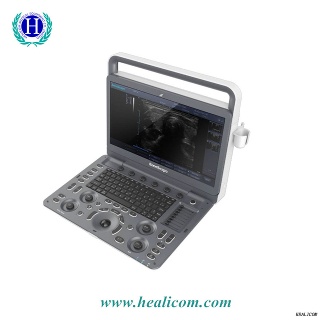 SonoScape E2 Professional Hospital ใช้ระบบวินิจฉัยเครื่องอัลตราซาวด์ Doppler แบบดิจิตอลเต็มรูปแบบ
