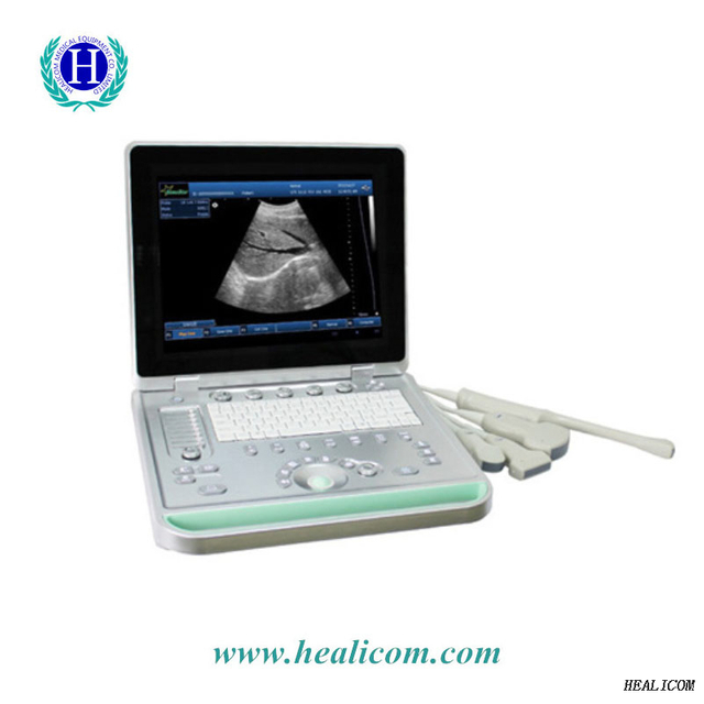 HV-9 Full Digital B/W Handheld Palm Veterinary Ultrasound Scanner แบบพกพา Vet Ultrasound