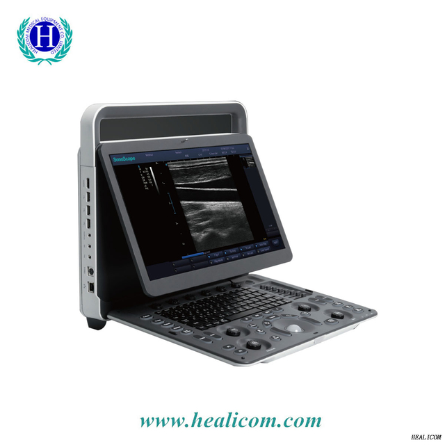 E1 Sonoscape Medical Portable Ultrasound Scanner ระบบเครื่องตรวจอัลตราซาวนด์สีดำและสีขาวราคา